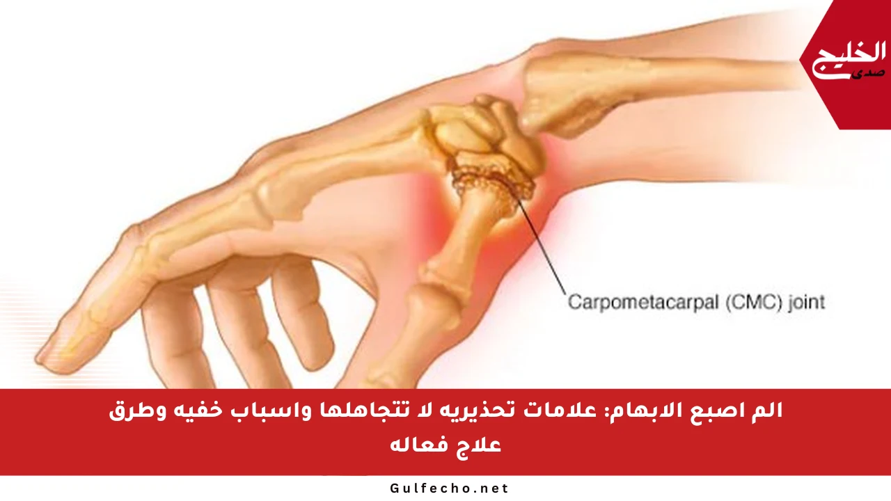 ألم إصبع الإبهام: علامات تحذيرية لا تتجاهلها وأسباب خفية وطرق علاج فعالة